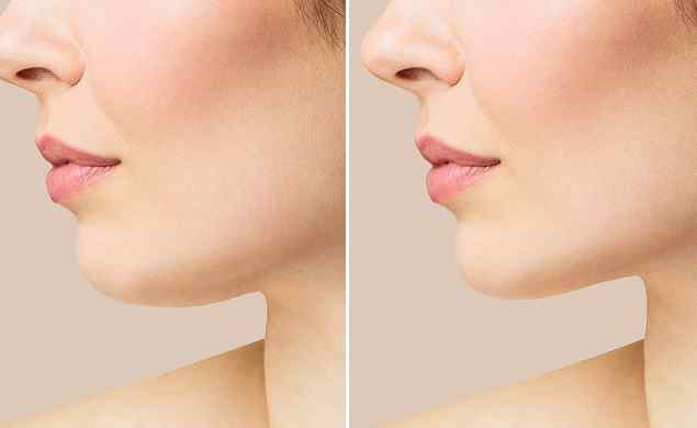 https://benb.rooienbart.nl/wp-content/uploads/sites/10/2026/05/image_before_after_02.jpg