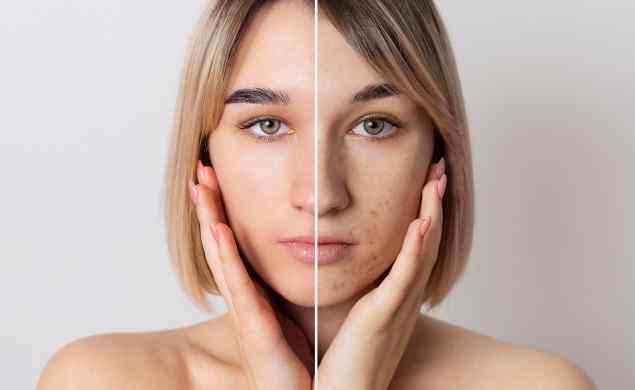 https://benb.rooienbart.nl/wp-content/uploads/sites/10/2026/05/image_before_after_04.jpg